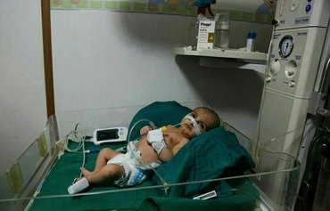اطباء يطالبون بإجلاء الأطفال من الغوطة