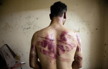 تقرير من الأمم المتحدة يكشف عقدا من ʼمعاناة لا توصفʻ يعيشها المعتقلين في سوريا